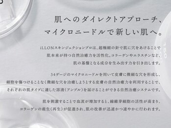 ルヴニール/