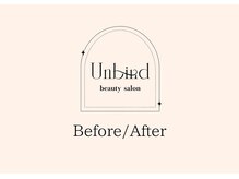 アンバインド(Unbind)/BEFORE/AFTER
