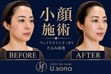 サロン ド ナース ユー ソナ(salon de nurse U.sona)