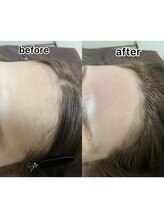 ルナソル 昭島店(LUNASOL)/フェイシャルワックス