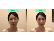 アジール 長岡リバーサイド千秋店(agir)/before/after画像