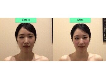アジール 長岡リバーサイド千秋店(agir)/before/after画像