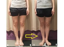 プラスファイン(+fine)/シン・O脚矯正、1回でこの効果！