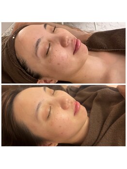 ポルボ(POLBO)/黄ぐすみや美白ケアも導入ケアで