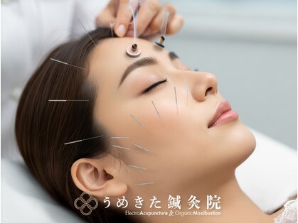 うめきた鍼灸院 センス(SENSE)の写真