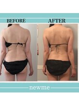 ニュウミー 諏訪本店(newme)/お客様ビフォーアフター