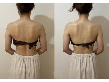 ソルナ 桜新町店(SOLUNA)/首凝り、肩こりスッキリ♪