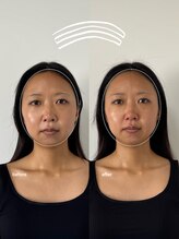 こつこつラボ サンイチマル オオル(310/OOL')/［30代/フェイスライン/むくみ］