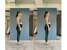 エヌピラティス 神戸三宮店(Nピラティス)/妊娠中のケアも安心