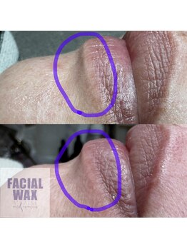 アレーズファイブフォー(A’LAISE54)/フェイシャルWAX