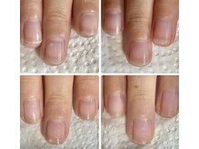 スターネイル(Starnail)/ネイルケアで縦長美人