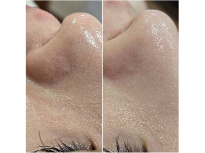 イチグラム(Ichi Glam)の写真