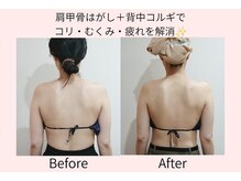 肩甲骨・肩首コリ集中コースで頑固なコリ・むくみも解消♪