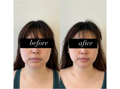 ボディメンテナンス 北方の写真