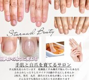 スターネイル(Starnail)
