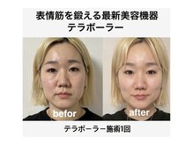 ラキネイ 目黒(Lakinei)の雰囲気（一度で実感！切らなくても叶うリフトアップ！理想の小顔へ♪）