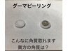 【新規大人気！】１度で驚くほどのツルツルお肌へ♪　ダーマピーリング