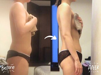 バーリブール 恵比寿店(BERLIBUR)/before/after