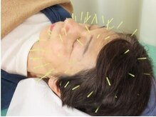 南花畑接骨・鍼灸マッサージ院の雰囲気（お顔の不安などもご相談いただけます）