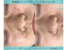 リメイク 広尾(REMAKE)/