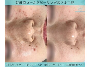 リメイク 広尾(REMAKE)/