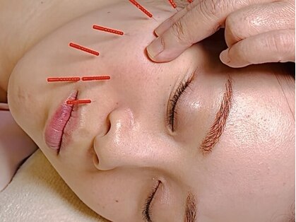 鍼灸 エル治療院の写真