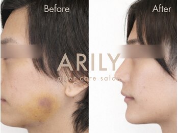 アリリィ(ARILY)/ARILY after care salon