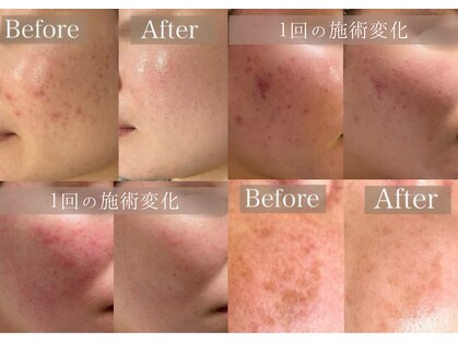 ルラシェ(Relacher)の写真