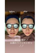 スタジオ オグラ(Studio-Ogura)/ピーリングイメージ１