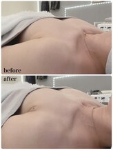 リアン 栄店(Lien)/バスト施術１回目Before★After