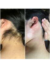 リバース 大波止店/