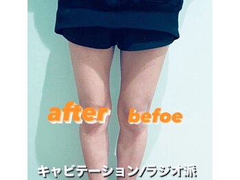 アイピー(I.P)/before after
