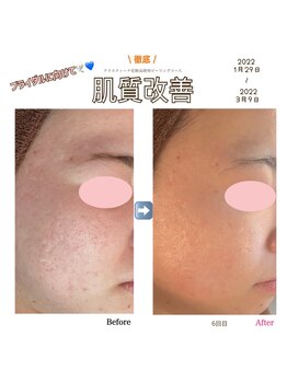 アイリス(AIRIS)/ブライダルに向けて♪