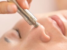 エラフリー/ダイヤモンドピーリング☆角質に