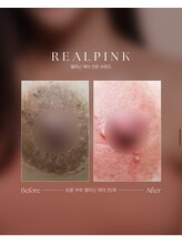 アネラ(ANELA)/Real Pink