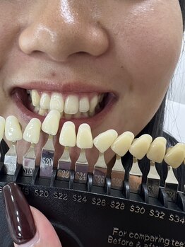 エクシアホワイトニング 王寺店/トーンチェック!