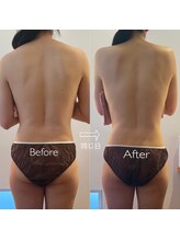 フセヤ &nbsp;エステティックアロマヨガスクール(FUSEYA)/WINBACK　ボディ　一宮/癒し