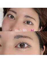 イチマルゴ ガーデン(105 GARDEN)/ラッシュリフト