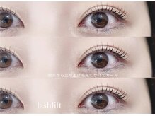 フラックスアンドビューティー(flax&BEAUTY)の雰囲気（一時の美しさだけでなく、5年後も健やかな目元であるために。）