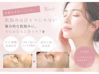 セメ(S'aimer)の写真/○シミ・くすみ・色ムラに○大人女性の複合的な肌悩みを肌状態に合わせて集中ケア