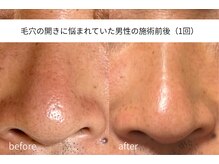 アイリス(iris)/メンズ歓迎◎
