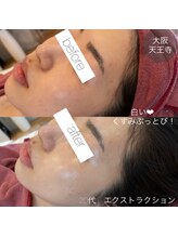 アンク(Ankh)/こんな肌になりたかった！