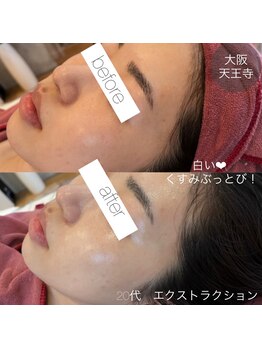 アンク(Ankh)/こんな肌になりたかった！