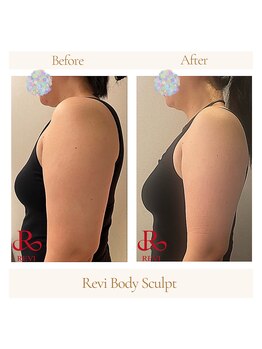 ルヴィショップ 沖縄(REVI SHOP)/REVIスカルプト