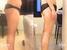 バーリブール 恵比寿店(BERLIBUR)/before/after