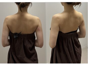 スキャプレーン 米子(SCAPLANE)/ブライダルコース 写真例