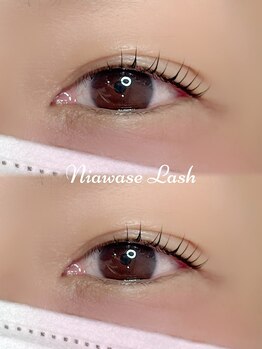 トラスト(Trust)/韓国風ロッドでパッチリ上向き☆