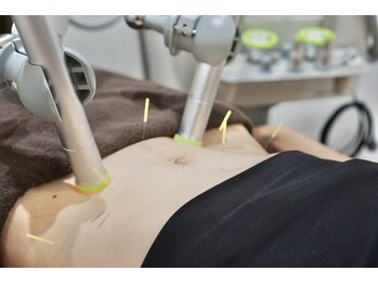 伊集院鍼灸整体院 津田沼院/スーパーライザー光線&鍼灸