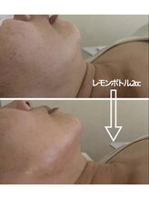 エンドット(EN.)/