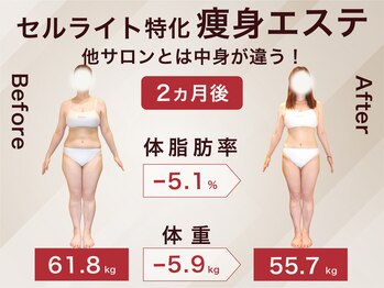 ラ パルレ 名古屋本店/全身セルライトケア